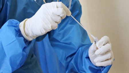 دراسة: كورونا قد تسبب جلطات دماغية حتى لصغار السن