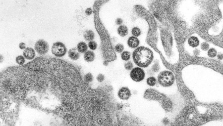 وفاة شخص بـ حمى لاسا في بريطانيا .. ومخاوف من تفشي المرض في البلاد
