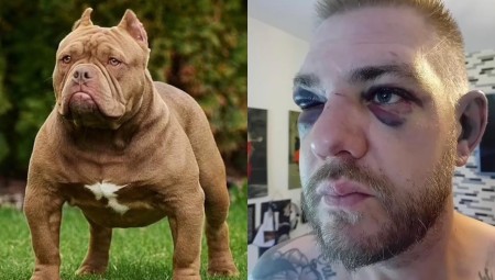 بالصور: بريطاني يتعرض لهجوم من كلب XL Bully بعد دفاعه عنهم واعتراضه على قرار حظرهم