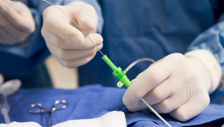 أخطاء جراحية مروعة في NHS: إزالة جزء من عمود امرأة الفقري بالخطأ تسبب في شللها