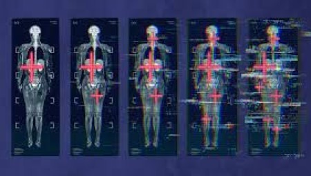 علماء يكشفون عن أكبر مشروع مسح شامل للجسم لفهم الشيخوخة والأمراض