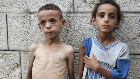 الغارديان تنشر تقريرًا مروّعًا عن المجاعة في غزة: أطفال كالهياكل العظمية يموتون جوعًا