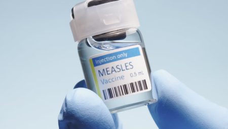 أكثر من 60 طفلاً مصابًا بحصبة شمال لندن.. والسلطات تحذر من تفشي واسع