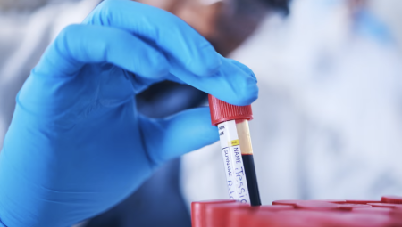 اختبار دم عبر وخزة الإصبع قد يكشف الأمراض قبل 10 سنوات من ظهور الأعراض